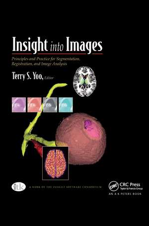 Insight into Images: Principles and Practice for Segmentation, Registration, and Image Analysis de Terry S. Yoo