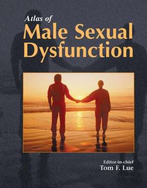 Atlas of Male Sexual Dysfunction de A. D'Ortona