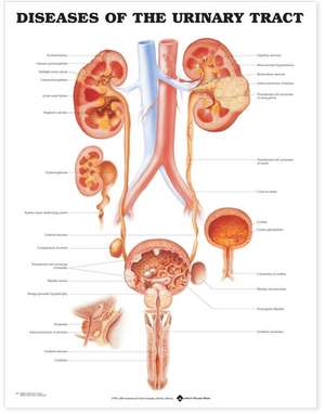 Diseases of the Urinary Tract Anatomical Chart de Anatomical Chart Company