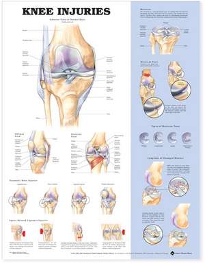 Knee Injuries Anatomical Chart de Anatomical Chart Company