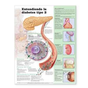 Understanding Type 2 Diabetes Anatomical Chart in Spanish (Comprendiendo la diabetes tipo 2) de Anatomical Chart Company