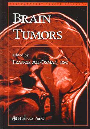 Brain Tumors de Francis Ali-Osman