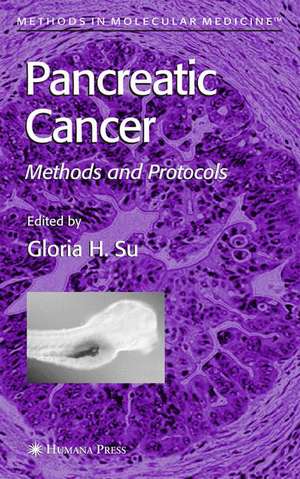 Pancreatic Cancer: Methods and Protocols de Gloria H. Su