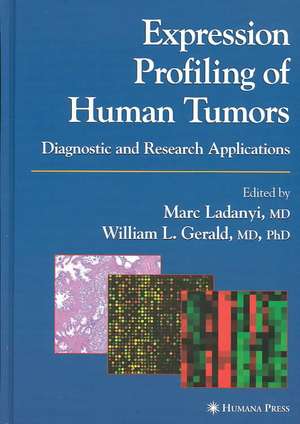 Expression Profiling of Human Tumors: Diagnostic and Research Applications de Marc Ladanyi