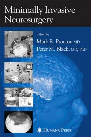 Minimally Invasive Neurosurgery de Mark R. Proctor