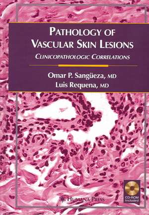 Pathology of Vascular Skin Lesions: Clinicopathologic Correlations de Omar P. Sangüeza