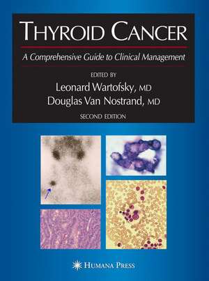 Thyroid Cancer: A Comprehensive Guide to Clinical Management de Leonard Wartofsky