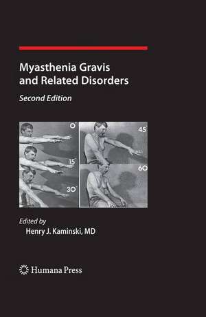 Myasthenia Gravis and Related Disorders de Henry J. Kaminski