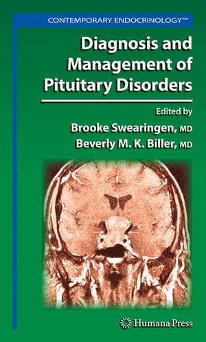 Diagnosis and Management of Pituitary Disorders de Brooke Swearingen