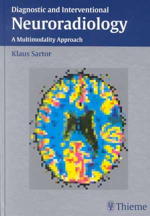 Diagnostic and Interventional Neuroradiology de Klaus Sartor