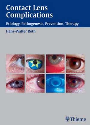 Contact Lens Complications de Hans-Walter Roth