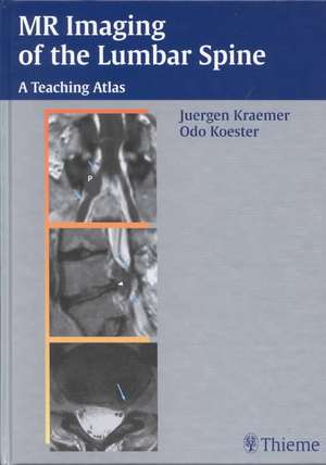 MR Imaging of the Lumbar Spine: A Teaching Atlas de Juergen Kraemer