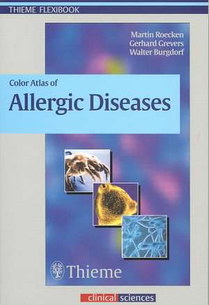 Color Atlas of Allergic Diseases de Martin Rocken