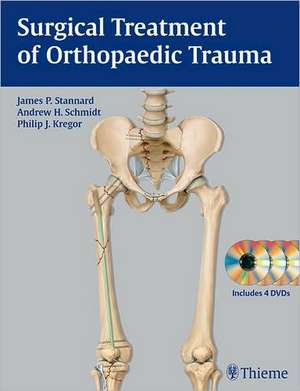 Surgical Treatment of Orthopaedic Trauma de James P. Stannard