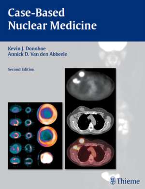 Case–Based Nuclear Medicine de Kevin J. Donohoe