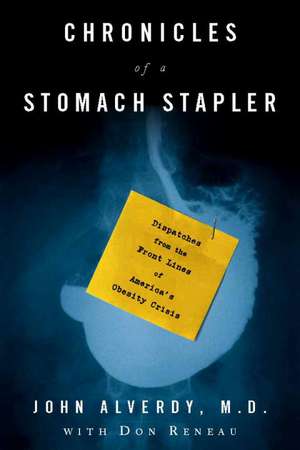 Chronicles of a Stomach Stapler: Dispatches from the Front Lines of America?s Obesity Crisis de Don Reneau