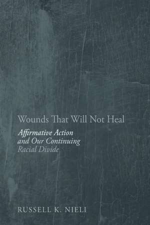 Wounds That Will Not Heal: Affirmative Action and Our Continuing Racial Divide de Russell K Nieli