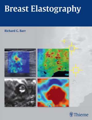 Breast Elastography de Richard G. Barr