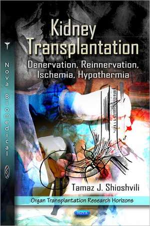 Kidney Transplantation de Tamaz J. Shioshvili