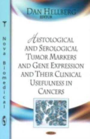 Histological & Serological Tumor Markers & Gene Expression & Their Clinical Usefulness in Cancers de Dan Hellberg