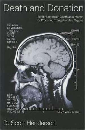 Death and Donation: Rethinking Brain Death as a Means for Procuring Transplantable Organs de D. Scott Henderson