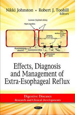 Effects, Diagnosis and Management of Extra-Esophageal Reflux de Nikki Johnston