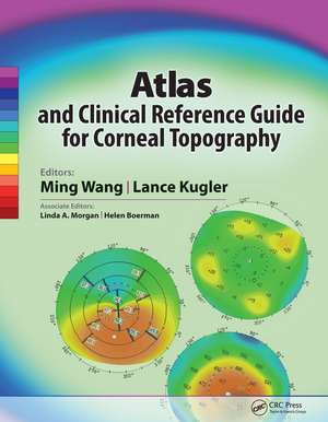 Atlas and Clinical Reference Guide for Corneal Topography de Ming Wang