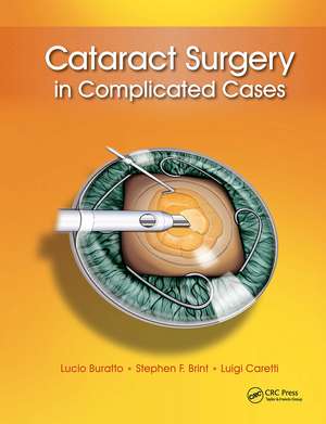 Cataract Surgery in Complicated Cases de Lucio Buratto