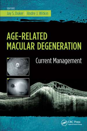 Age-Related Macular Degeneration: Current Management de Jay Duker