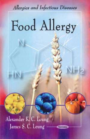 Food Allergy de Alexander K. C. Leung