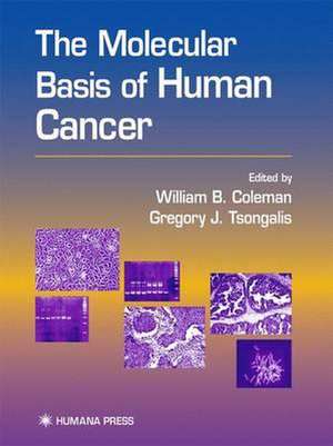 The Molecular Basis of Human Cancer de William B. Coleman