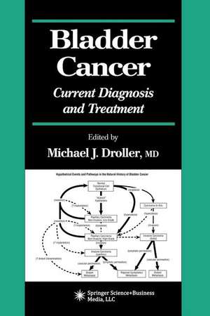 Bladder Cancer: Current Diagnosis and Treatment de Michael J. Droller