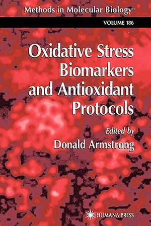 Oxidative Stress Biomarkers and Antioxidant Protocols de Donald Armstrong