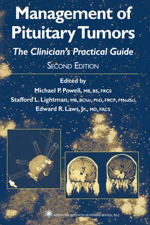 Management of Pituitary Tumors: The Clinician’s Practical Guide de Michael P. Powell