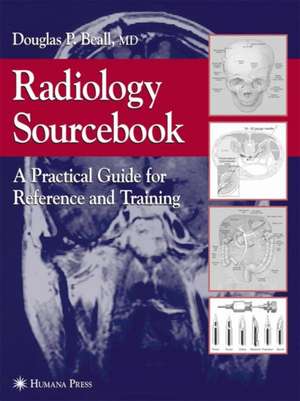 Radiology Sourcebook: A Practical Guide for Reference and Training de Douglas P. Beall