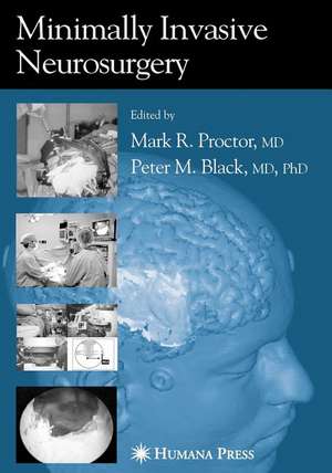 Minimally Invasive Neurosurgery de Mark R. Proctor