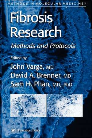 Fibrosis Research: Methods and Protocols de John Varga