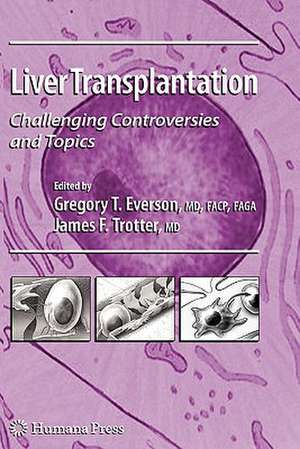 Liver Transplantation: Challenging Controversies and Topics de Gregory T. Everson