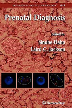 Prenatal Diagnosis de Sinuhe Hahn