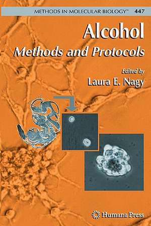 Alcohol: Methods and Protocols de Laura E. Nagy