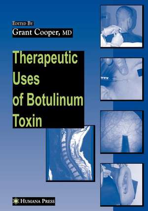 Therapeutic Uses of Botulinum Toxin de Grant Cooper