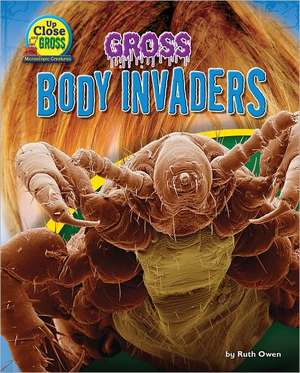 Gross Body Invaders de Ruth Owen