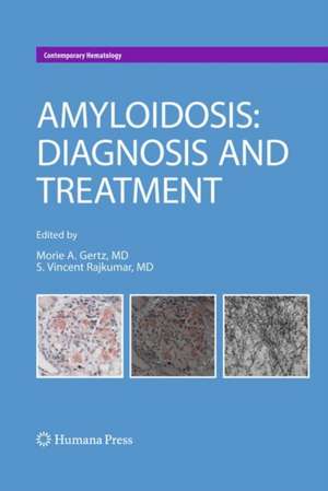 Amyloidosis: Diagnosis and Treatment de Morie A. Gertz