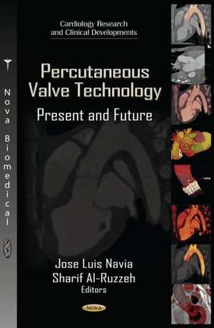 Percutaneous Valve Technology de Jose Navia