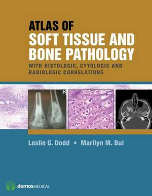 Atlas of Soft Tissue and Bone Pathology: With Histologic, Cytologic, and Radiologic Correlations de Marilyn M. Bui