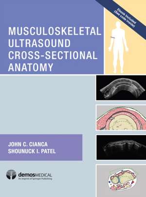 Musculoskeletal Ultrasound Cross Sectional Anatomy de John Cianca