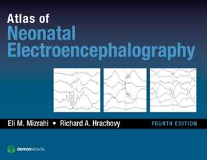 Atlas of Neonatal Electroencephalography, Fourth Edition: Getting Started de Eli M. Mizrahi