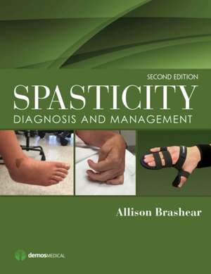 Spasticity: Diagnosis and Management de Allison Brashear