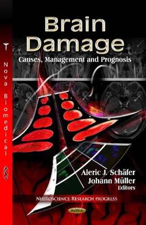 Brain Damage de Aleric J. Schafer