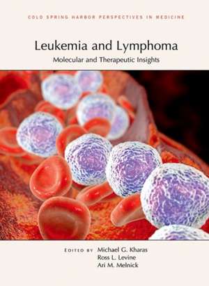 Leukemia and Lymphoma de Michael G Kharas